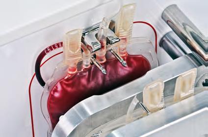 Экстрактор компонентов крови автоматический NOVOMATIC