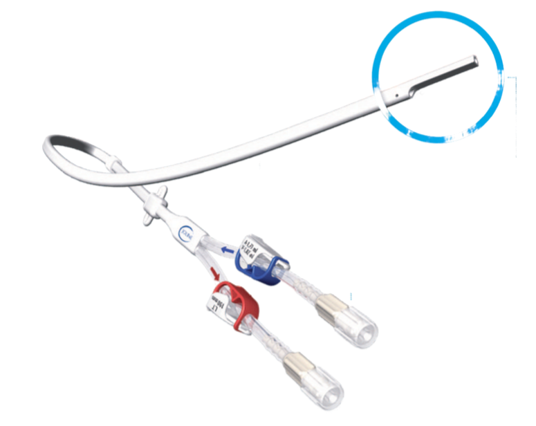 Катетер для гемодиализа долгосрочный, двухпросветный, антероградный D= 6,1*3,5 мм (15,5 Fr), длина 190/270 мм, силикон